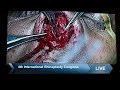 Jaipurdoorbeen hospital live stream