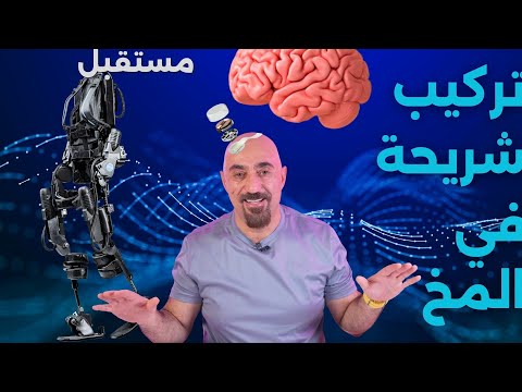 مستقبل زراعة شرائح في المخ