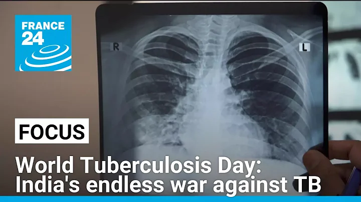 World Tuberculosis Day: India's endless war against TB • FRANCE 24 English