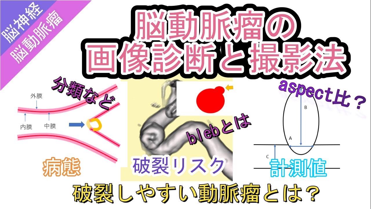 Bleb 脳動脈瘤 | 脳動脈瘤 未破裂 : bleb 脳動脈瘤 について掘り下げる – QHNZE