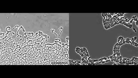 Pseudomonas aeruginosa biofilm expansion via twitching motility