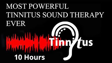 MOST POWERFUL TINNITUS SOUND THERAPY EVER Tinnitus Treatment Ringing in ears Tinnitus Masking Sounds