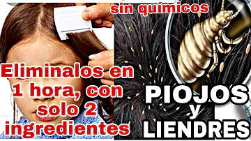 ¿Cuál es la forma más rápida de deshacerse de los piojos sin productos químicos?