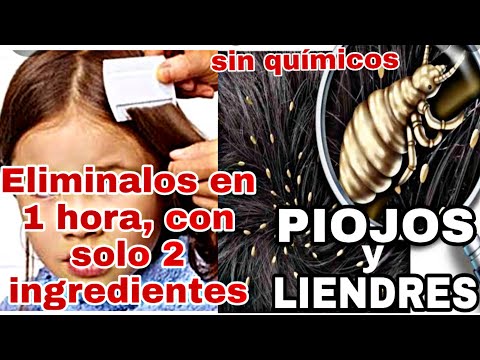 Video: ¿El tinte para el cabello matará los piojos?