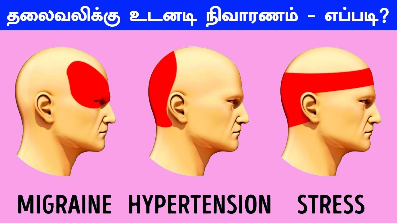 த ர த தல வல க க உடனட த ர வ க ட க க ம Get Rid Of Headache Immediately Tamil Bells Youtube