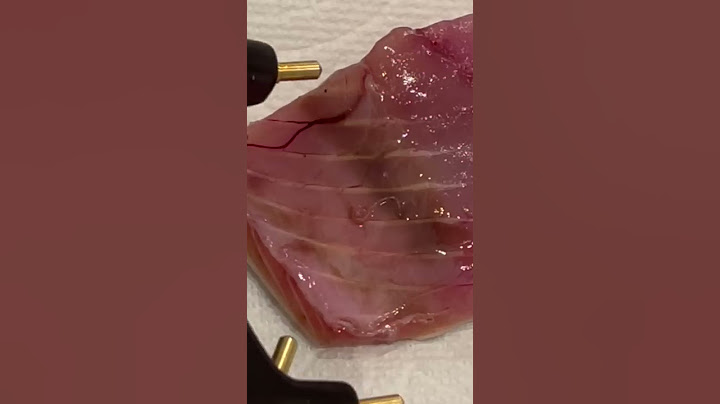寄生虫がいる魚の身に電流を流すと。。。#shorts
