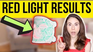 DO LED LIGHT MASKS REALLY WORK? | Dermatologist reviews Omnilux screenshot 3