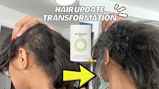 HUGE HAIR Transformation + Hair Loss & CCCA Update (honest Nutrafol review)