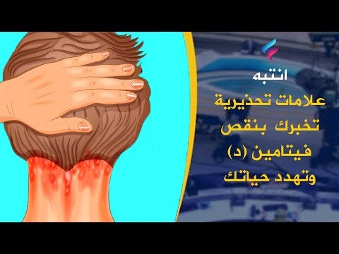 فيديو: ما هو بيان الحجم الشائع ماذا يظهرون؟