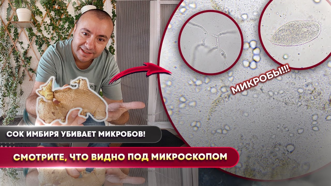 Имбирь против микробов под микроскопом 🔬 Реальный эксперимент!