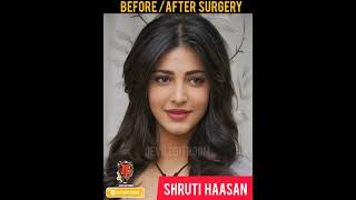 Shruti Haasan Face 😱 Before Surgery 😱 OMG Pablo Sandhanam #shorts #youtubeshorts #viral #trending