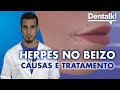 HERPES NO BEIZO - Tratamento, causas e síntomas (en galego) | Dentalk! ©