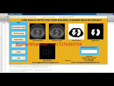 Lung Nodule Segmentation Using Machine Learning Lung Nodule Classification Using Matlab Project Code