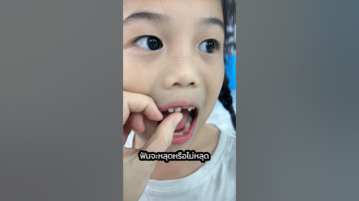 ฟันซี่ที่สี่ของมิราจะหลุดหรือไม่หลุด😂