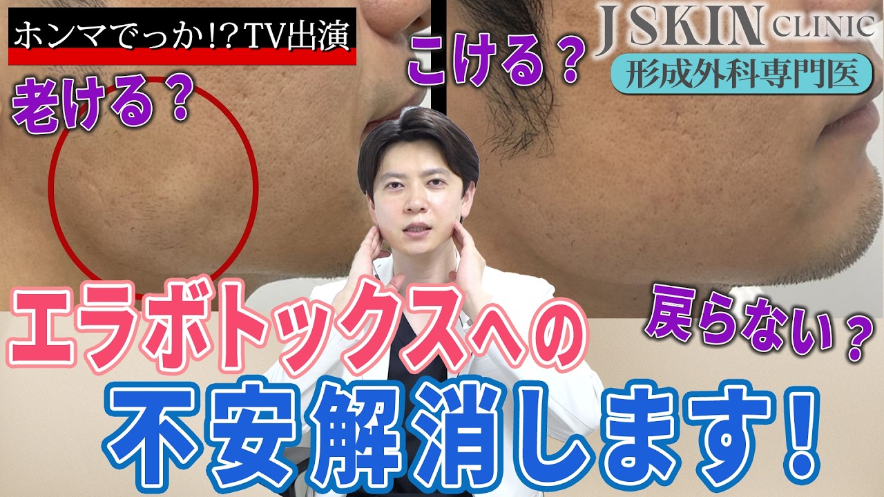 エラ ボトックス 老ける