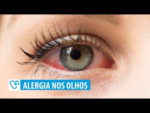 Vídeo: O olho lacrimejante é uma alergia?