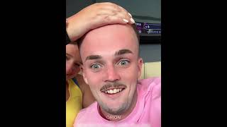 Celebrity Big Forehead Prank 💀 Profile