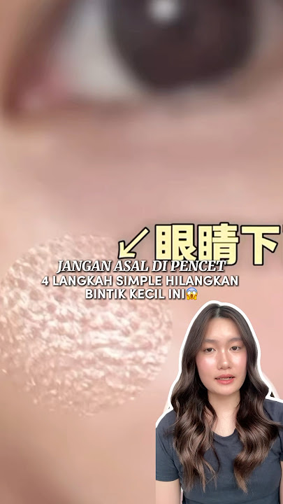 Siapa juga yang ada bintik-bintik ini di mata??😱