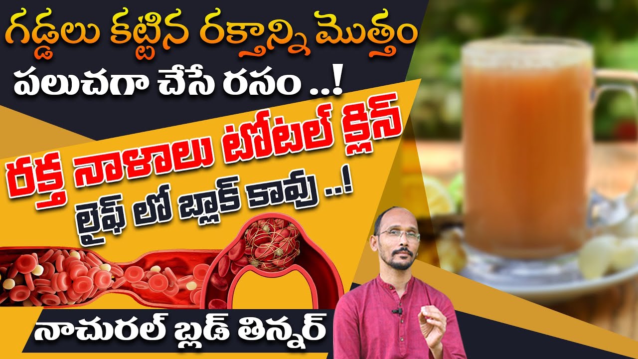 రక్తాన్ని మొత్తం పలుచగా చేసే రసం ..! రక్త నాళాలు టోటల్ క్లిన్ | Dr. MadhuBabu | Health Trends |
