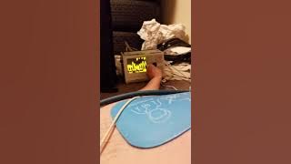 Transcutaneous Pacing makes my heart pound