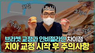 치아교정 시작 후 주의사항과 꿀팁!│브라켓 교정과 인비절라인 차이점│교정 통증, 교정 음식, 구강관리, 장치착색, 교정장치