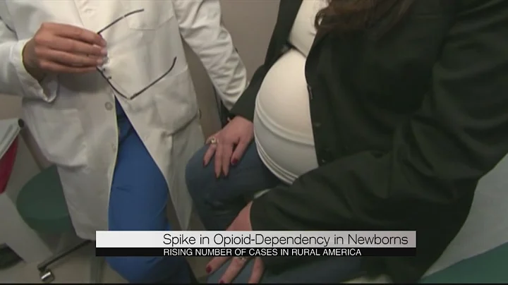 Drug Dependent Babies