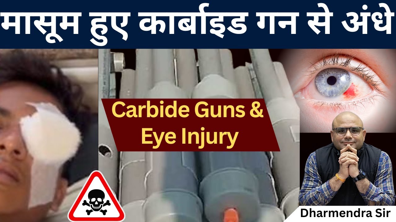 Carbide Gun & Eye Injury 