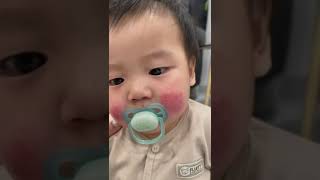 rash on baby cheek? help?! | ssen