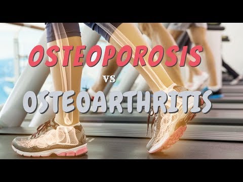 Video: Perbezaan Antara Osteoartritis Dan Osteoporosis