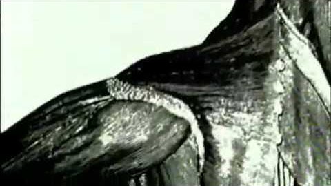 Mystery Diagnosis - FOP Part 1