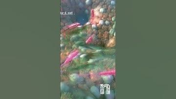 New Insights on E. coli & Colon Cancer! 🧬