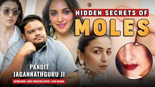 Understanding Moles On Your Body Mystery Of Mole On Body Learn Palmistry