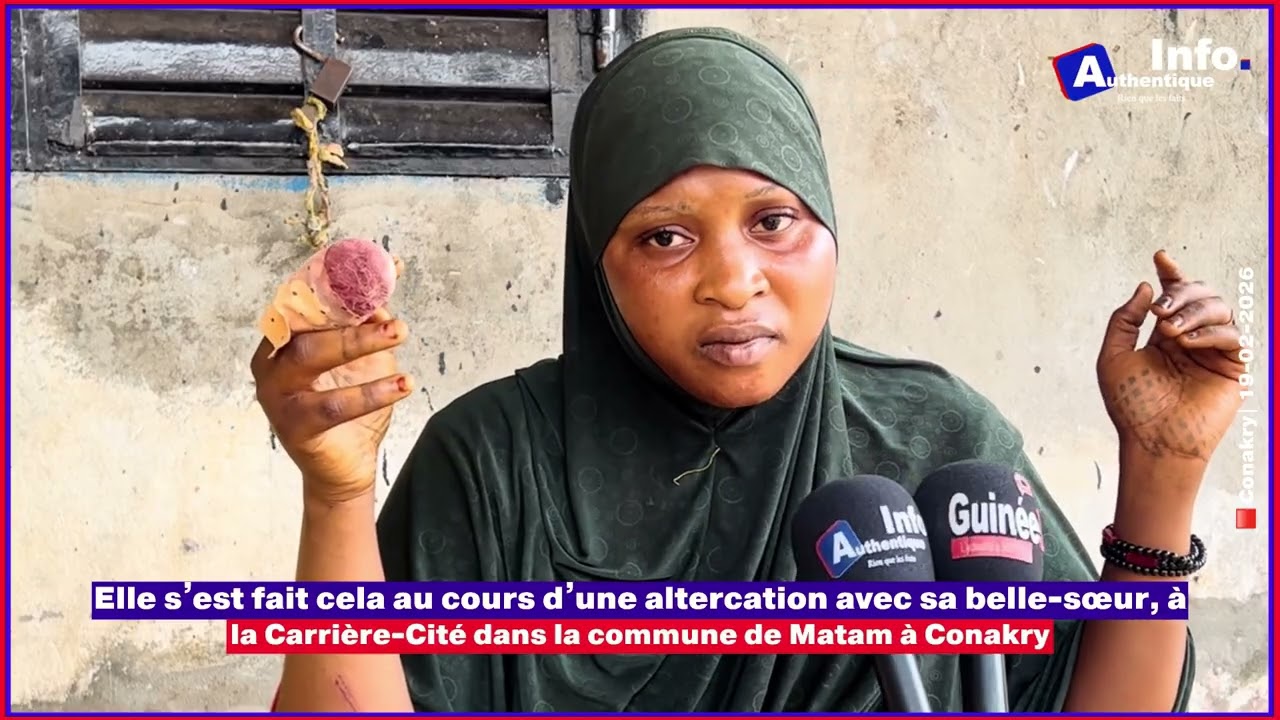 🚨🇬🇳| Elle s’est fait cela au cours d’une altercation avec sa belle-sœur, à la Carrière-Cité ⬇️