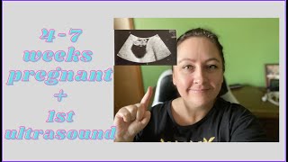 4 - 7 WEEKS PREGNANCY UPDATE: first prenatal appointment by T&G Life 221 views 1 year ago 10 minutes, 35 seconds