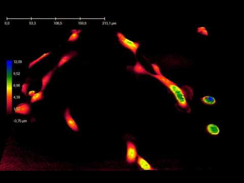 Live MCF10A Human Mammary Epithelial Cell Motion Seen Using The Holomonitor H4