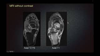 Sports Medicine Case 12: 16-year-old: Gymnast with Foot Pain