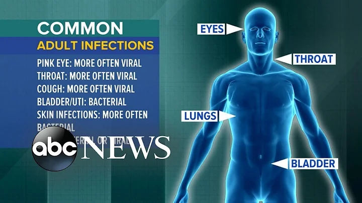 The disturbing findings on overuse of antibiotics