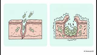 How does declining oestrogen impact the healing time of surgical wounds, ta... | WHC Clinical FAQ