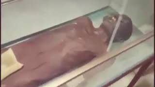 死亡博物館! 地方病 検索動画22 死亡博物館! 地方病 検索動画 22