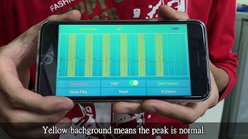 2019 AICAS Live Demo ECG monitor with AI algorithm