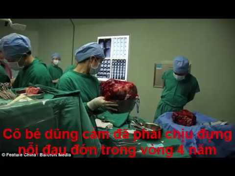 Video 14Clip hít KINH HOÀNG ĐƯA ẤU TRÙNG QUÁI VẬT RA KHỎI BÉ... - youtube