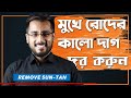 ছেলেদের মুখের রোদে পোড়া দাগ দূর করুন ঘরে বসে  ।  remove sun tan from face at home #Tonmoy