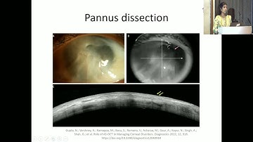 AIOCMTC4 2025 GP15 T Dr Deepthi Prabhakar Iyer Asoct a diagnostic tool