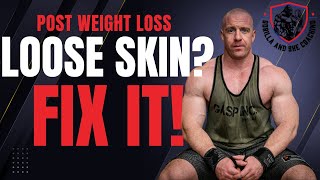 How to fix stretch marks and loose skin after weight loss