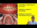 Ortodoncia en una  Paciente que tenía Desviación de la Mandíbula 😎 Es lo Tuyo también?