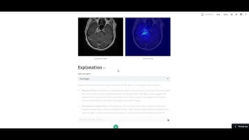 Brain MRI Tumor Detection - CNN Model, Detailed Report, Chatbot
