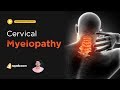 Cervical Myelopathy | Orthopaedic Surgery | Medical Student Lectures | V-Learning