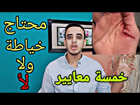 فيديو: كيف تستريح بعيونك مفتوحة (بالصور)