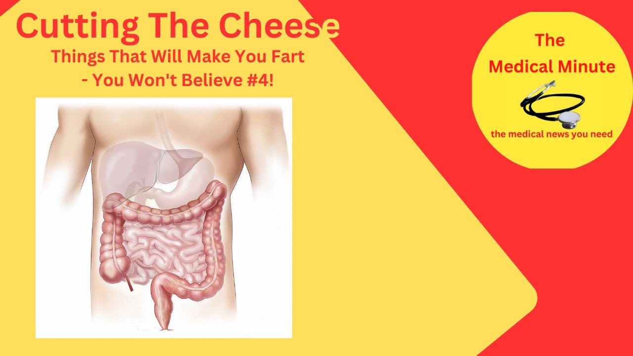 LETTING ONE RIP, CUTTING THE CHEESE, BREAKING WIND OR FARTING. 5 ITEMS