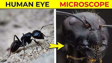 15 Things You Can See Only Under Microscope | Fact Minded